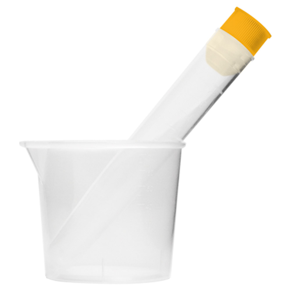 Kit coleta de urina estéril - 1 Tubo tampa amarela